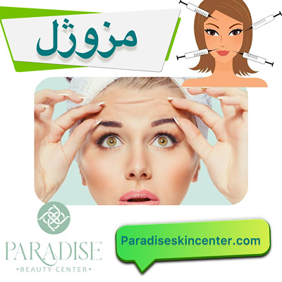 مزوژل