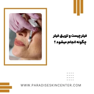 فیلر چیست و تزریق فیلر چگونه انجام میشود ؟