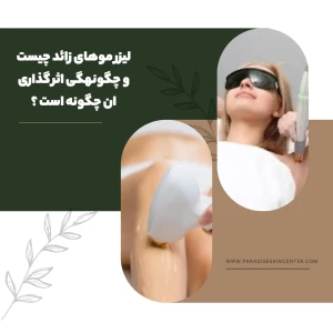 لیزر موهای زائد چیست و چگونهگی اثر گذاری ان چگونه است ؟
