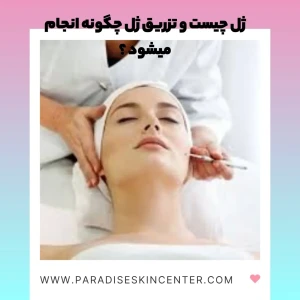 ژل چیست و تزریق ژل چگونه انجام میشود ؟