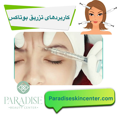 کاربردهای تزریق بوتاکس