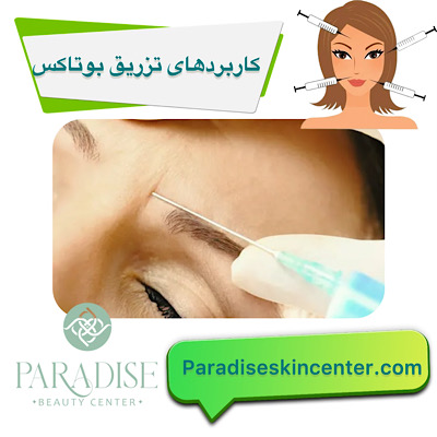 کاربردهای تزریق بوتاکس