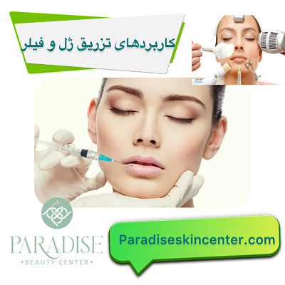 کاربرد های تزریق ژل و فیلر 