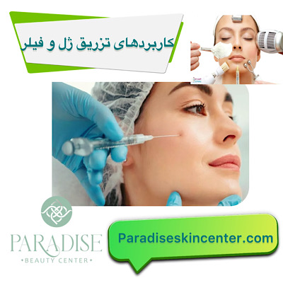 کاربرد های تزریق ژل و فیلر 