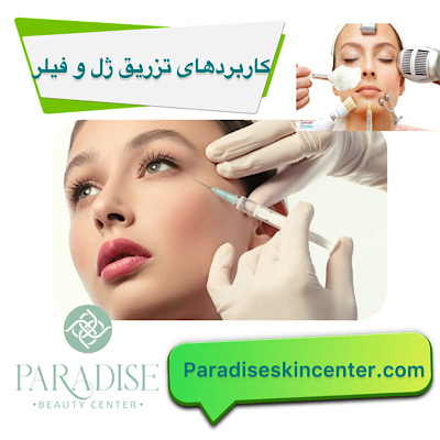 کاربرد های تزریق ژل و فیلر 
