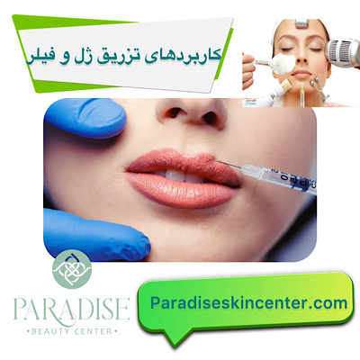 کاربرد های تزریق ژل و فیلر 
