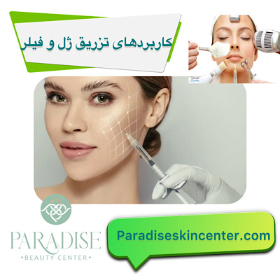 کاربرد های تزریق ژل و فیلر 