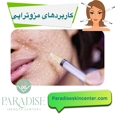 کاربردهای مزوتراپی