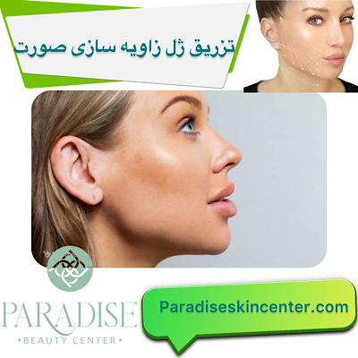 تزریق ژل و فیلر برای زاویه‌سازی