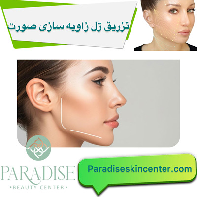 تزریق ژل و فیلر برای زاویه‌سازی