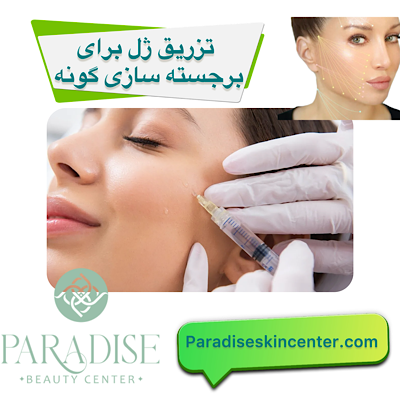 تزریق ژل برای برجسته‌سازی گونه‌ 