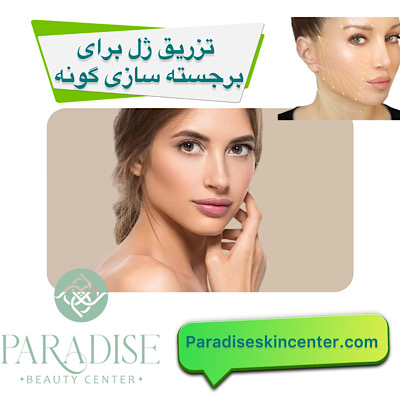 تزریق ژل برای برجسته‌سازی گونه‌ 
