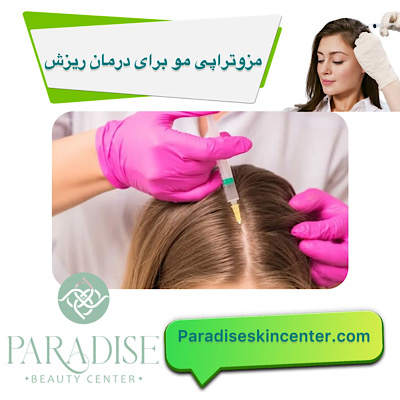 مزوتراپی مو برای درمان ریزش