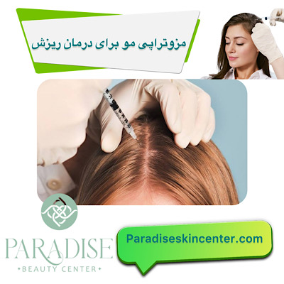 مزوتراپی مو برای درمان ریزش