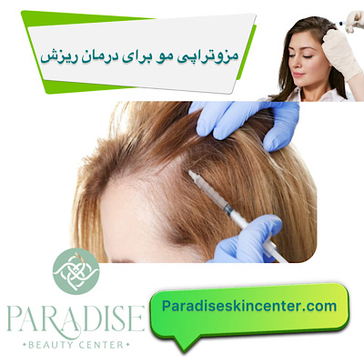 مزوتراپی مو برای درمان ریزش