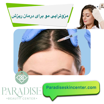 مزوتراپی مو برای درمان ریزش