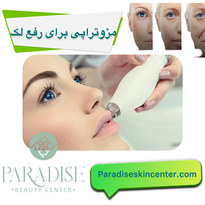 مزوتراپی برای رفع لک‌ 