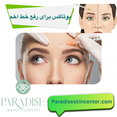 بوتاکس برای رفع خط اخم