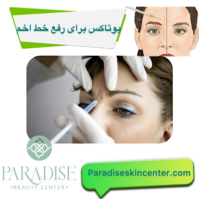 بوتاکس برای رفع خط اخم