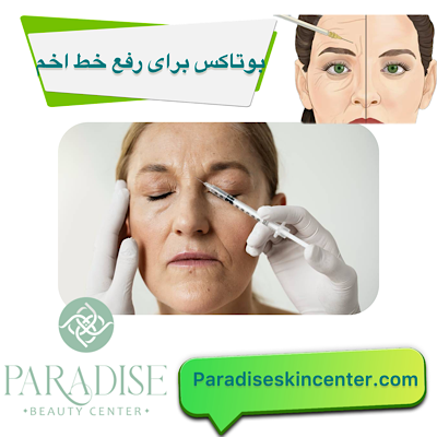 بوتاکس برای رفع خط اخم