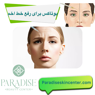 بوتاکس برای رفع خط اخم