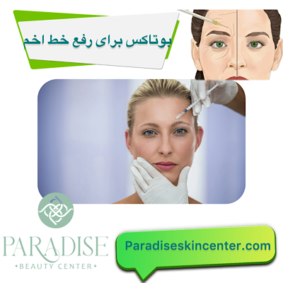 بوتاکس برای رفع خط اخم