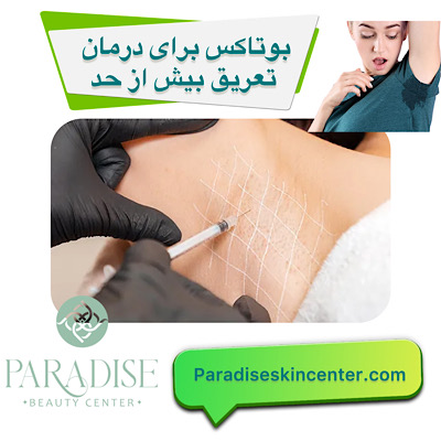 بوتاکس برای درمان تعریق بیش‌ازحد 