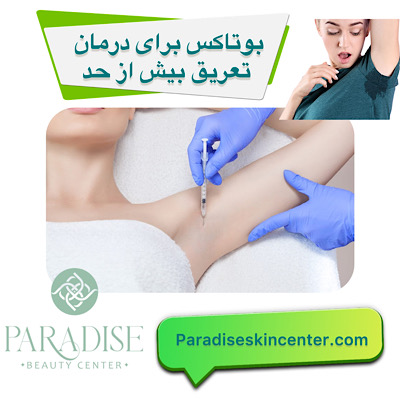 بوتاکس برای درمان تعریق بیش‌ازحد 