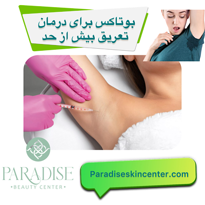 بوتاکس برای درمان تعریق بیش‌ازحد 