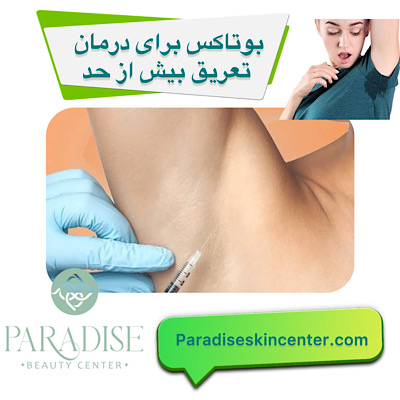 بوتاکس برای درمان تعریق بیش‌ازحد 