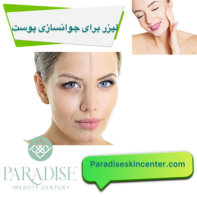 لیزر برای جوان‌سازی پوست