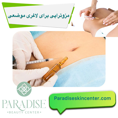 مزوتراپی برای لاغری موضعی