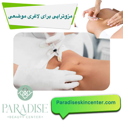 مزوتراپی برای لاغری موضعی