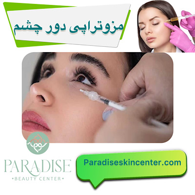 مزوتراپی دور چشم
