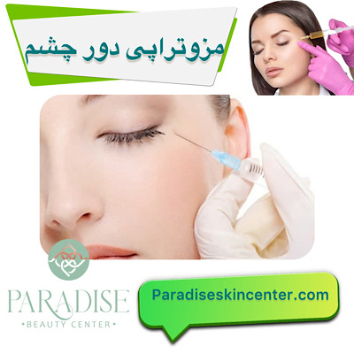 مزوتراپی دور چشم