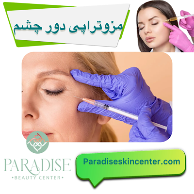 مزوتراپی دور چشم