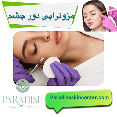 مزوتراپی دور چشم