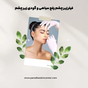 فیلر زیر چشم رفع سیاهی و گودی زیر چشم