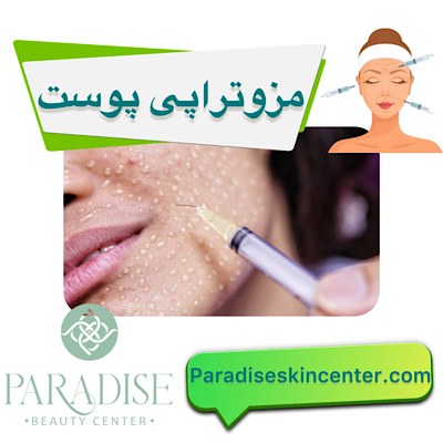 مزوتراپی پوست