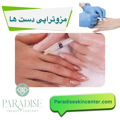 مزوتراپی دست‌ها