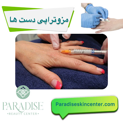 مزوتراپی دست‌ها