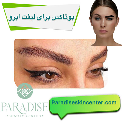 بوتاکس برای لیفت ابرو