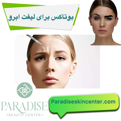 بوتاکس برای لیفت ابرو