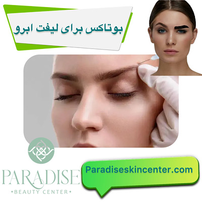 بوتاکس برای لیفت ابرو