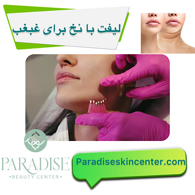 لیفت با نخ برای غبغب