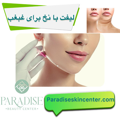 لیفت با نخ برای غبغب