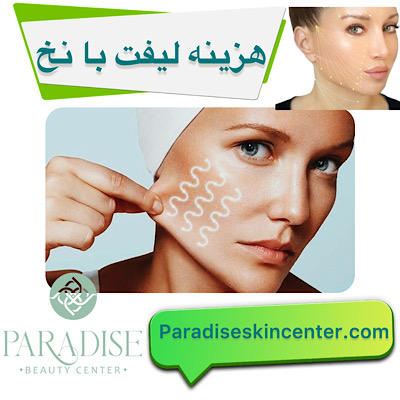 هزینه لیفت با نخ