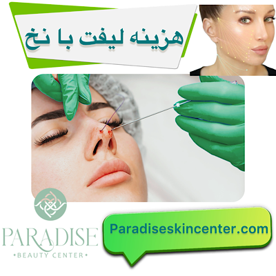 هزینه لیفت با نخ