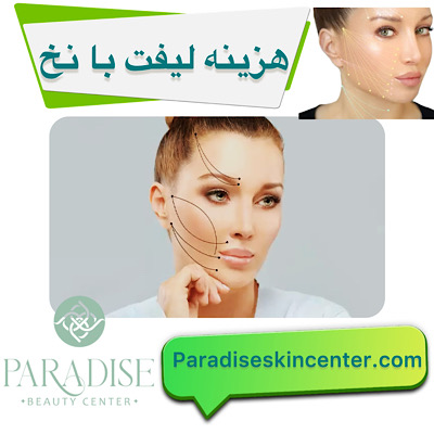 هزینه لیفت با نخ