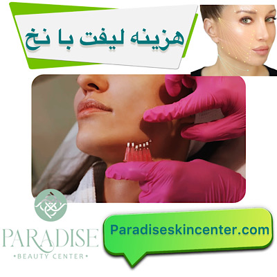 هزینه لیفت با نخ